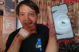 Sedang Mencari Pakan Ternak di Persawahan, Warga Madiun Jadi Korban Peluru Nyasar